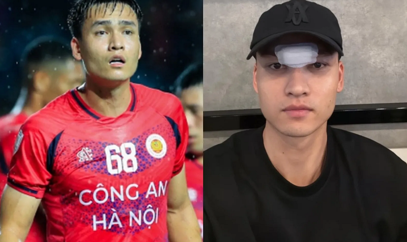 bui-hoang-viet-anh-khau-14-mui-sau-pha-va-cham-kinh-hoang